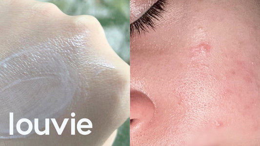 Cómo reparar la barrera cutánea: skincare coreano para restaurar y fortalecer tu piel