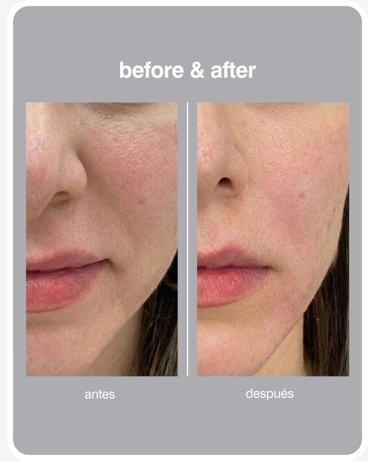 Retinol Intense Advanced Triple Action Eye Cream (Contorno de Ojos)